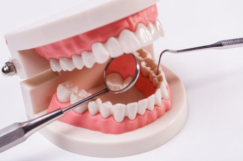 dental crowns